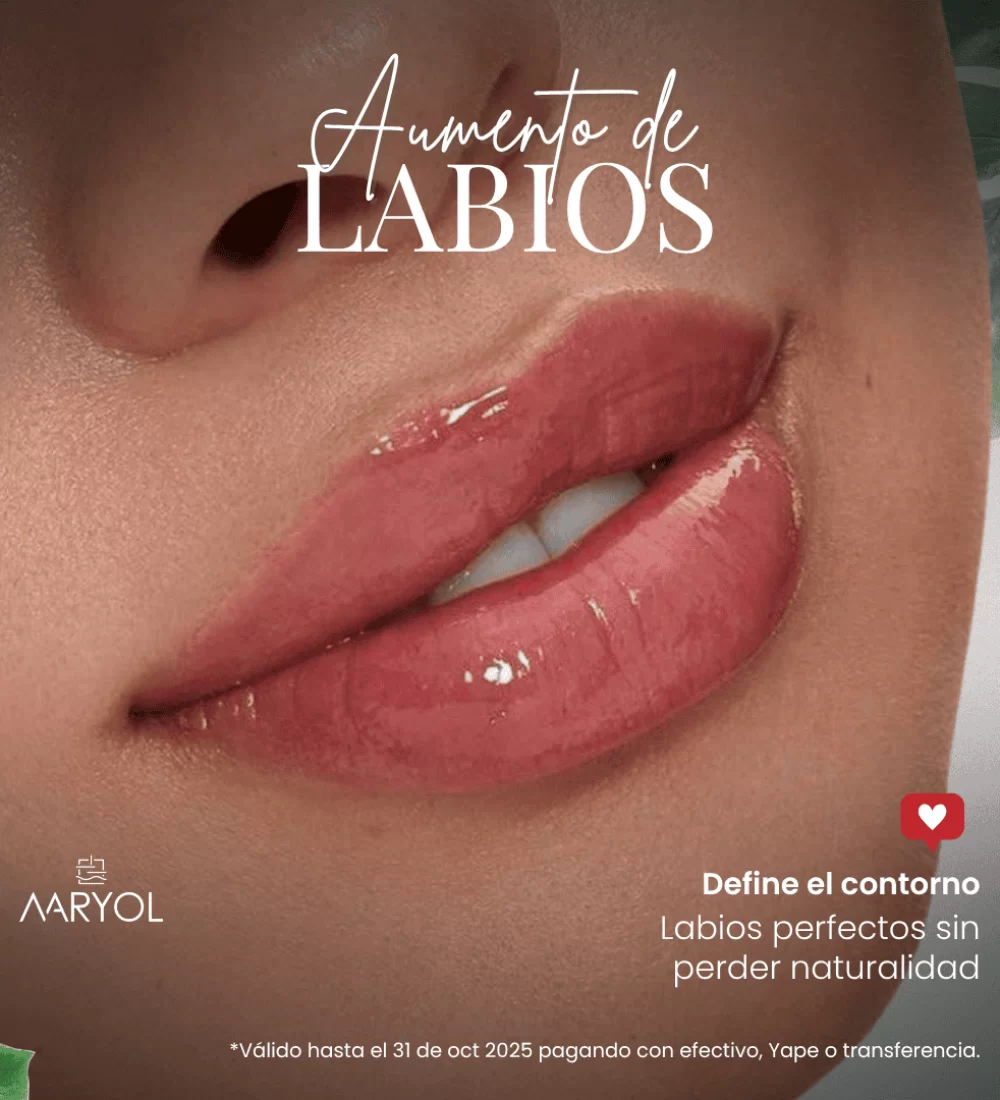 Aumento de labios con hialurónico en Lima